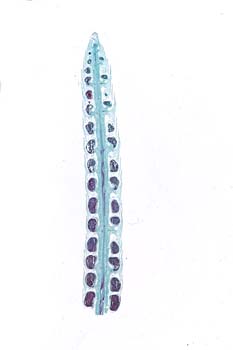 lycopodium